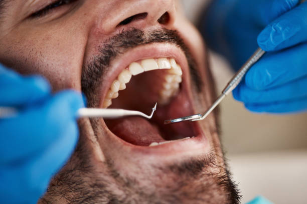 Best Broken Tooth Emergency  in Dearborn Heights, MI