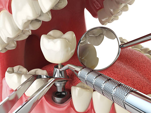 Best Urgent Tooth Repair  in Dearborn Heights, MI